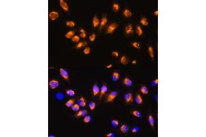 Immunohistochemistry (IHC) image for anti-Arrestin, beta 2 (ARRB2) (AA 300-400) antibody (ABIN3021620)