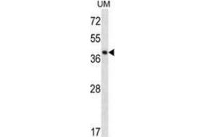 Western blot analysis in UM cell line lysates (35ug/lane) using SPOPL  Antibody . (SPOPL antibody  (Middle Region))