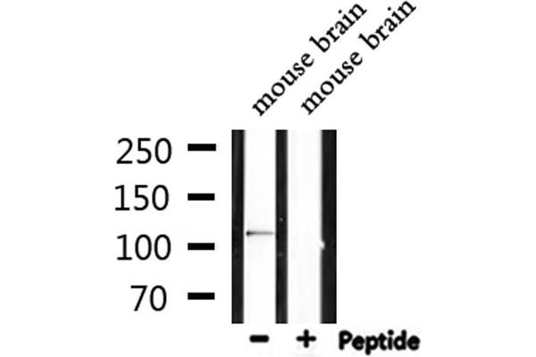 IFIH1 antibody  (C-Term)