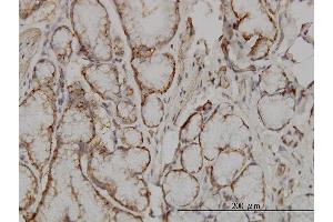 Immunoperoxidase of monoclonal antibody to SOCS5 on formalin-fixed paraffin-embedded human small Intestine. (SOCS5 antibody  (AA 1-110))