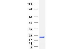 Validation with Western Blot (NCS1 Protein (Transcript Variant 1) (Myc-DYKDDDDK Tag))