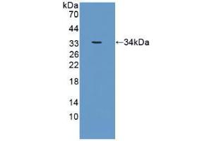 Western blot analysis of recombinant Human CRAT. (CRAT antibody  (AA 363-626))