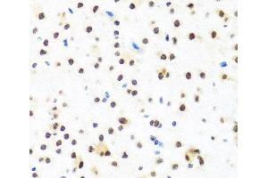 Immunohistochemistry of paraffin-embedded Mouse brain using FUBP1 Polyclonal Antibody at dilution of 1:100 (40x lens). (FUBP1 antibody)