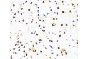 Immunohistochemistry of paraffin-embedded Mouse brain using FUBP1 Polyclonal Antibody at dilution of 1:100 (40x lens). (FUBP1 antibody)