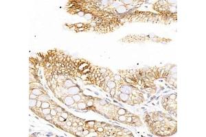 Immunohistochemistry of paraffin embedded rat colon using ATP1A1 (ABIN7073154) at dilution of 1: 500 (400x lens) (ATPase (Na/K) antibody)
