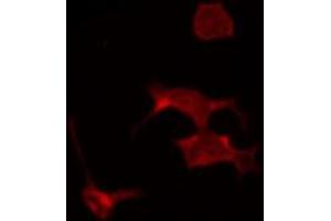 ABIN6267318 staining COS7 by IF/ICC. (Progesterone Receptor antibody  (pSer294))