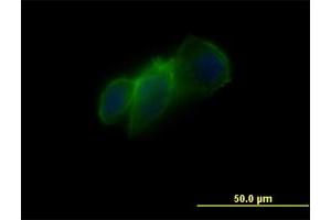 Immunofluorescence of monoclonal antibody to CDH11 on PC3-MM2 cell. (OB Cadherin antibody  (AA 54-612))