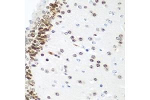 Immunohistochemistry of paraffin-embedded mouse brain using UBE2U antibody (ABIN6130858, ABIN6149825, ABIN6149826 and ABIN6224418) at dilution of 1:100 (40x lens). (UBE2U antibody  (AA 1-226))