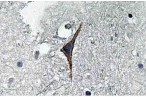 Immunohistochemistry (IHC) analyzes of NOS3 antibody in paraffin-embedded human brain tissue. (ENOS antibody)