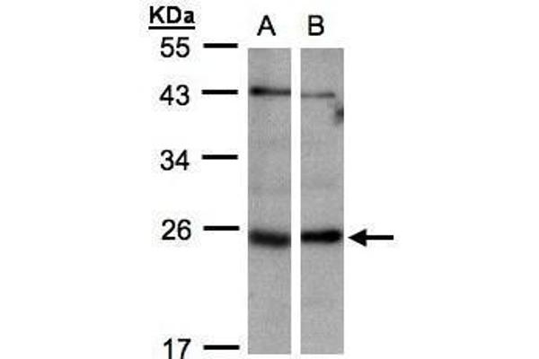 ITPA antibody