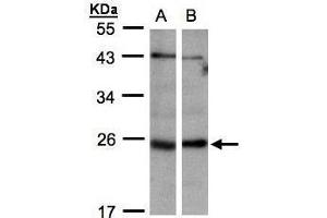 WB Image Sample(30 ug whole cell lysate) A:293T B:Hep G2 , 12% SDS PAGE antibody diluted at 1:1000 (ITPA antibody)