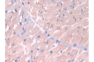 Immunohistochemistry (IHC) image for anti-Janus Kinase 2 (JAK2) (AA 916-1103) antibody (ABIN7438352)