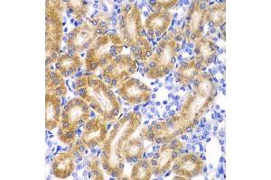 Immunohistochemistry of paraffin-embedded rat kidney using RPN1 antibody.