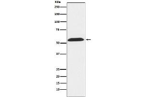 Western blot analysis of TXNRD2 expression in LnCap cell lysate.