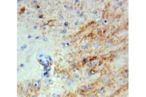 #VALUE! (INHBB antibody  (AA 50-404))