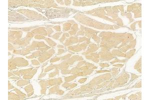 ABIN6258589 and ABIN6275045 at 1/100 staining human tongue carcinoma by IHC-P.