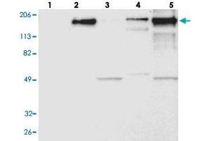 Western blot analysis of Lane 1: RT-4, Lane 2: U-251 MG, Lane 3: A-431, Lane 4: Liver, Lane 5: Tonsil with LAMB2 polyclonal antibody .