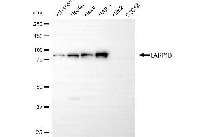 Western blotting analysis using LARP1B antibody (ABIN7799223).