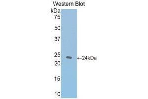 Western Blotting (WB) image for anti-Thrombospondin 1 (THBS1) (AA 61-259) antibody (ABIN1173301) (Thrombospondin 1 antibody  (AA 61-259))