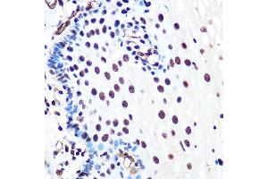 Immunohistochemistry of paraffin-embedded human esophageal using Ku80 Rabbit mAb (ABIN7271406) at dilution of 1:100 (40x lens). (XRCC5 antibody)