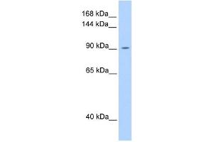 OSMR antibody used at 1 ug/ml to detect target protein. (Oncostatin M Receptor antibody  (N-Term))