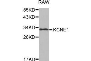 Western blot analysis of extracts of RAW cell line, using KCNE1 antibody.