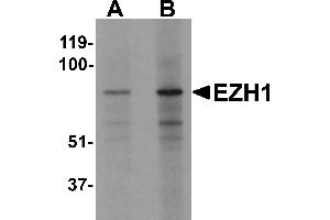 Western blot analysis of EZH1 in mouse lung tissue lysate with EZH1 antibody at (A) 1 and (B) 2 µg/mL (EZH1 antibody  (N-Term))