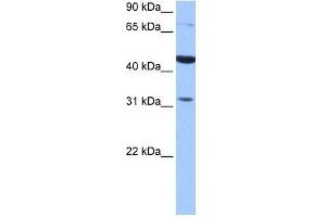 TPRXL antibody used at 0. (TPRXL antibody  (C-Term))