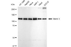 Western blotting analysis using Matrin 3 antibody (ABIN7799337).