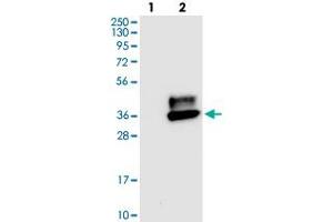 Western blot analysis of Lane 1: Negative control (vector only transfected HEK293T lysate), Lane 2: Over-expression Lysate (Co-expressed with a C-terminal myc-DDK tag (~3. (CEACAM1 antibody)