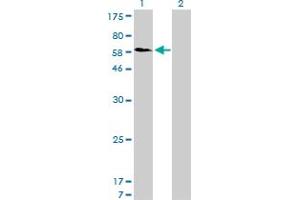 Western Blot analysis of SNX1 expression in transfected 293T cell line by SNX1 monoclonal antibody (M01), clone 6H1. (Sorting Nexin 1 antibody  (AA 166-275))