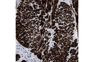 Immunohistochemical staining (Formalin-fixed paraffin-embedded sections) of human gallbladder shows strong cytoplasmic positivity in smooth muscle cells.
