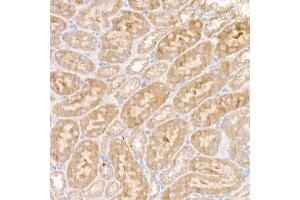 Immunohistochemistry of paraffin-embedded mouse kidney using NDUFS1 Rabbit pAb (ABIN7268819) at dilution of 1:50 (40x lens). (NDUFS1 antibody  (AA 80-290))