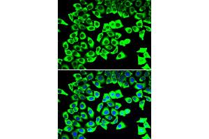 Immunofluorescence analysis of U2OS cells using RPLP2 antibody.