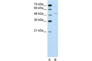 WB Suggested Anti-ZNF19 Antibody Titration:  0. (ZNF19 antibody  (N-Term))