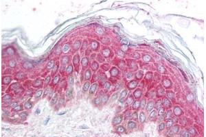 Human Skin (formalin-fixed, paraffin-embedded) stained with AVEN antibody ABIN213902 at 5 ug/ml followed by biotinylated goat anti-rabbit IgG secondary antibody ABIN481713, alkaline phosphatase-streptavidin and chromogen. (AVEN antibody  (N-Term))