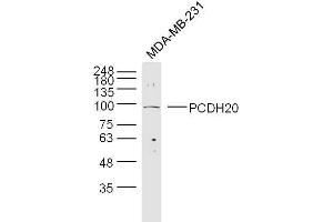 Lane 1: MDA-MB-231 cell lysates probed with 	PCDH20 Polyclonal Antibody, Unconjugated  at 1:300 overnight at 4˚C. (PCDH20 antibody  (AA 611-710))