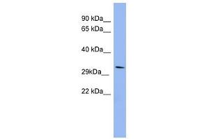 RRAD antibody used at 1 ug/ml to detect target protein. (RRAD antibody  (Middle Region))