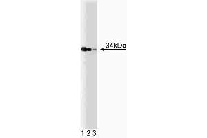 Western blot analysis of TRADD on a Jurkat cell lysate (Human T-cell leukemia, ATCC TIB-152). (TRADD antibody  (AA 163-312))
