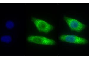 Detection of CTSZ in Human Hela cell using Polyclonal Antibody to Cathepsin Z (CTSZ) (Cathepsin Z antibody  (AA 24-303))