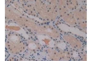 Immunohistochemistry (IHC) image for anti-Insulin-Like Growth Factor Binding Protein 1 (IGFBPI) (AA 36-235) antibody (ABIN7442780)