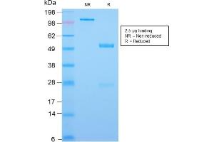 SDS-PAGE Analysis Purified CDX2 Rabbit Recombinant Monoclonal Antibody (CDX2/2951R). (Recombinant CDX2 antibody  (AA 150-249))