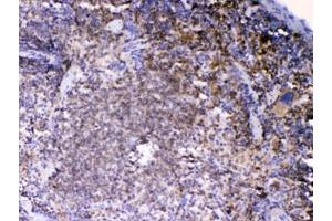 IHC testing of FFPE mouse spleen tissue with LYN antibody at 1ug/ml. (LYN antibody  (AA 470-501))