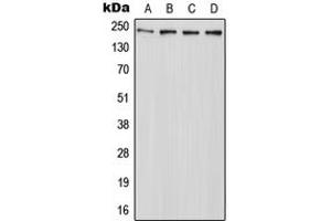 Western blot analysis of ABCA7 expression in HeLa (A), Raw264. (ABCA7 antibody  (C-Term))