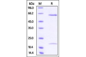 SDS-PAGE (SDS) image for Proprotein Convertase Subtilisin/kexin Type 9 (PCSK9) (AA 31-692) (Active) protein (His tag) (ABIN2870599)