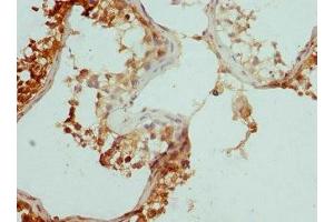 Immunohistochemistry of paraffin-embedded human testis tissue using ABIN7147358 at dilution of 1:100 (CG1331 Gene Product From Transcript CG1331-RA (CCP84AF) (AA 1-280) antibody)