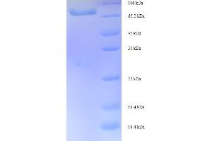 SDS-PAGE (SDS) image for Inositol-Trisphosphate 3-Kinase B (ITPKB) (AA 442-946) protein (His-SUMO Tag) (ABIN4976181)