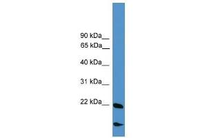 RBM18 antibody used at 0. (RBM18 antibody  (Middle Region))