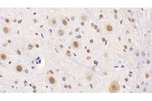 Detection of NCL in Mouse Cerebellum Tissue using Polyclonal Antibody to Nucleolin (NCL) (Nucleolin antibody  (AA 353-568))