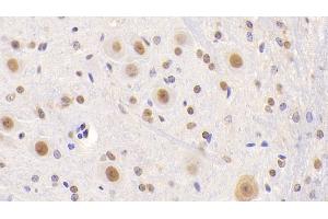 Detection of NCL in Mouse Cerebellum Tissue using Polyclonal Antibody to Nucleolin (NCL)